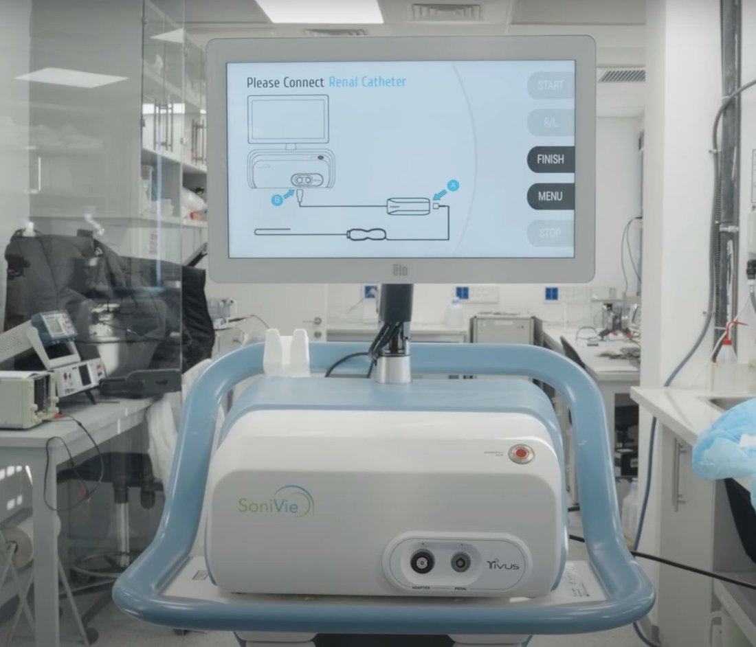 Sonivie clinical interface
